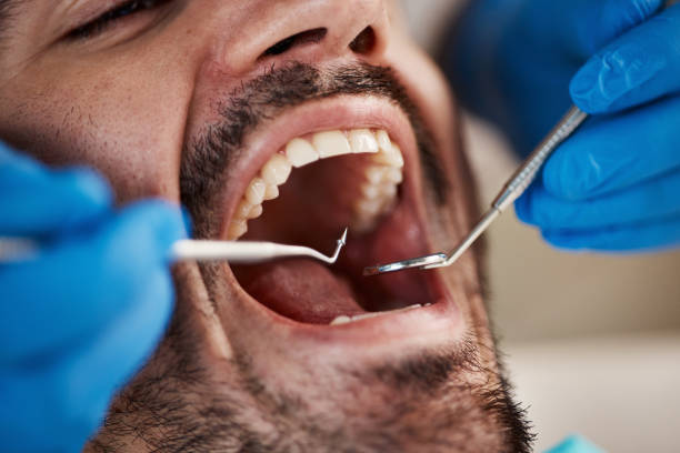 Dentist for Dental Trauma in HI